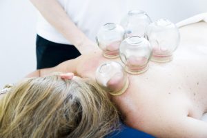 Home Fysiotherapeut voert cupping-behandeling uit ter ondersteuning van herstel bij sportblessures